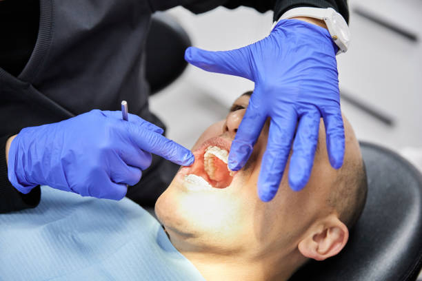 Best Emergency Dental Care for Broken or Chipped Teeth in Nash, TX